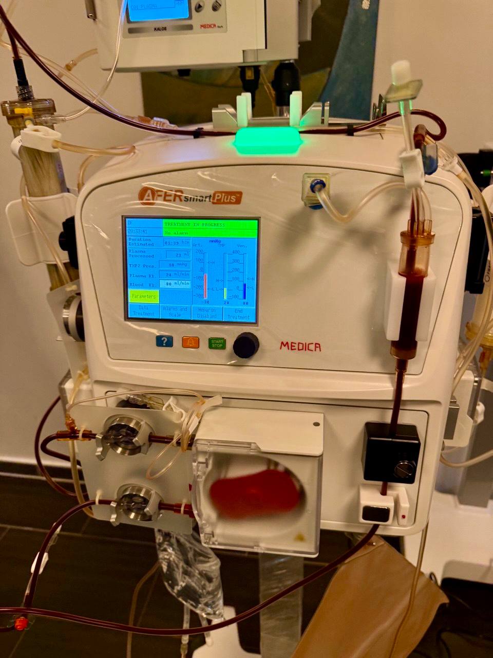 Enhanced mental clarity: DFPP against brain fog