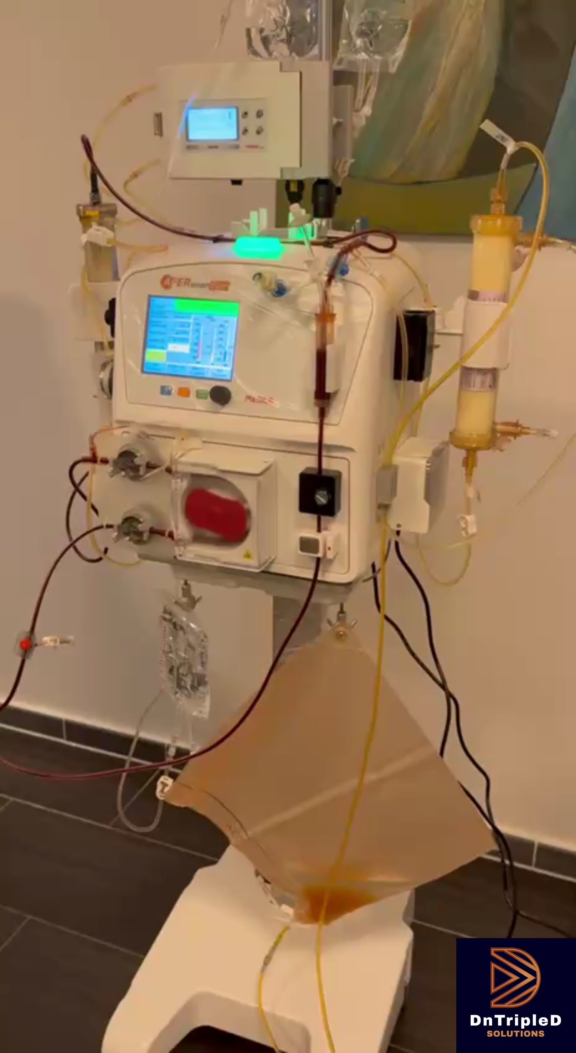 Equipment for plasmapheresis, DFPP